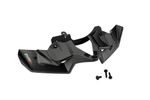  Carbon Appearance Roadster Front Fenders
